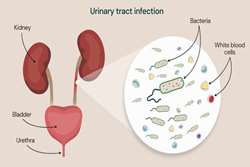 تایید یک آنتی‌بیوتیک جدید برای درمان عفونت ادراری غیرپیچیده