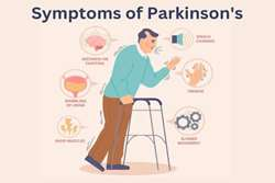 اثر مثبت آگونیست GLP1 بر روی پارکینسون: آری یا خیر؟