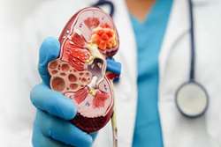 معرفی یک داروی جدید: Finerenone